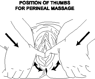 Female anatomy showing how to do perineal massage. Two thumbs are inserted into the vagina sweeping in a downward and side to side motion.